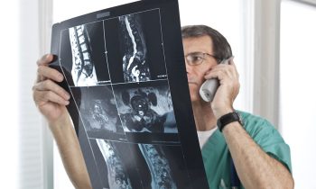 Legal Rights After a Spinal Cord Injury in a Bronx Car Accident